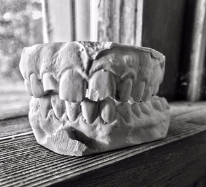 A cast of teeth sitting on a windowsill
