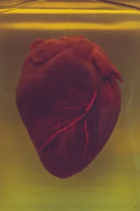 A human heart