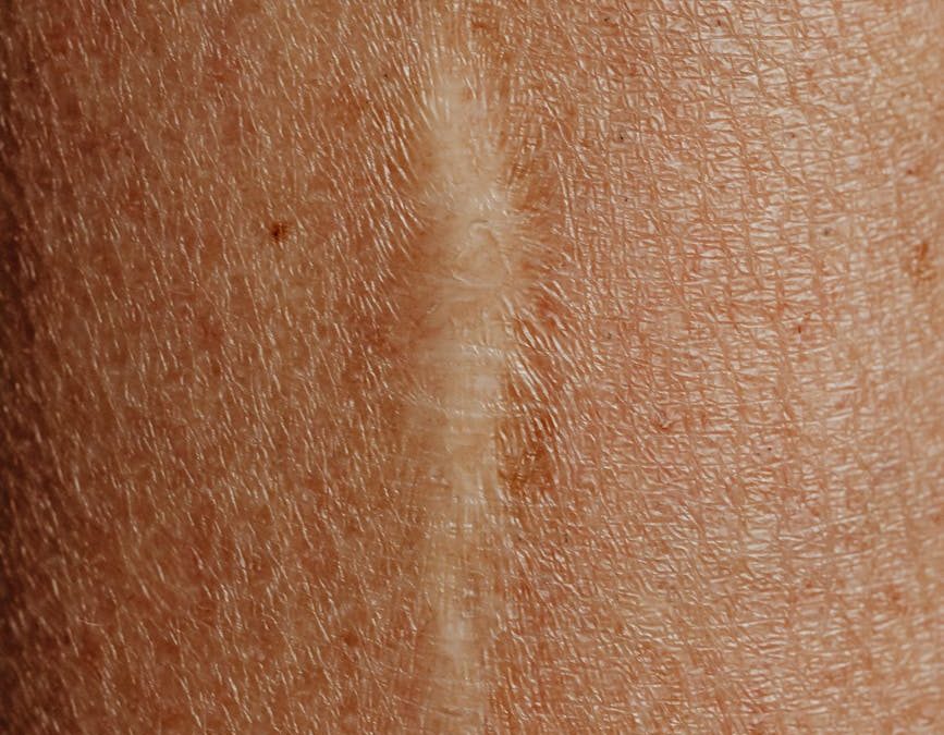 Self-Portrait of Someone Else by Dilys Wyndham Thomas